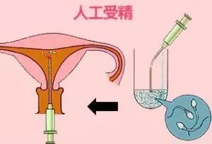 有偿捐卵