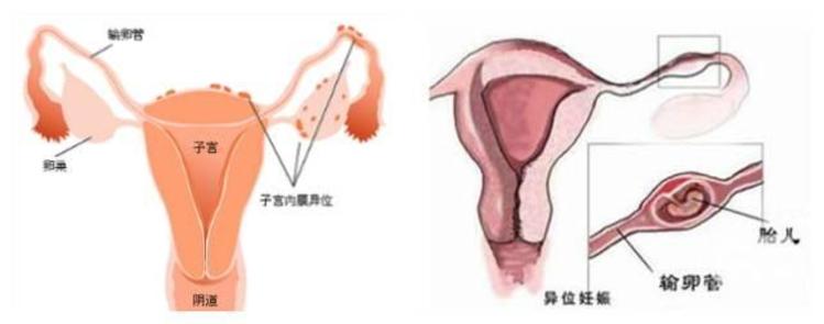 机构供卵